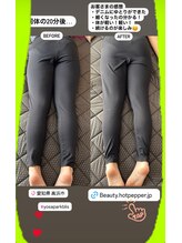 ヨサパーク ブリス(YOSA PARK blis)/リンパ施術前と施術後