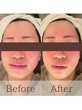 凪眠/小顔リンパフェイシャルの効果47