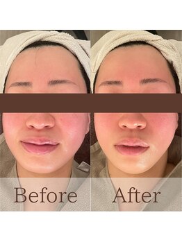 凪眠/小顔リンパフェイシャルの効果47