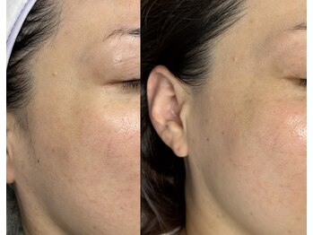 ベルード(veludo)/