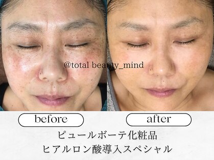 トータルビューティー マインド(Total Beauty)の写真