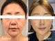 アトリエドゥアージュ(Atelier de age)の写真/福岡希少！最新しわ・たるみケア”光糸リフト”で年齢肌を変える大人女性のためのエイジングケア専門サロン