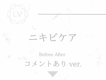 ラヴィオーラ 栄(LV)/ダイヤモンドハーブピーリング
