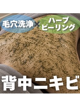 カナウ(KANAU)の写真/【毛穴洗浄＋ハーブピーリング】長年悩んだ繰り返す背中ニキビを卒業◎届かない背中はサロンにお任せ！！