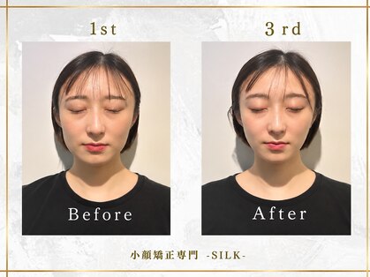 シルク(SILK)の写真