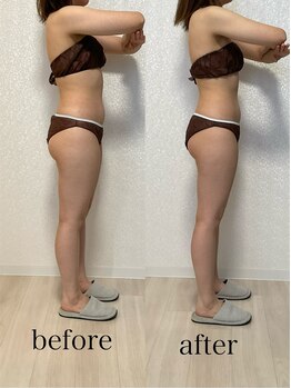 モンレーヴ(MonReve)/痛気持ちい！痩身マッサージ