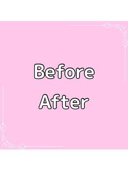 整体ニコナ(nicona)/