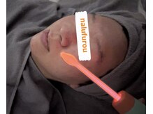 ナルフロウ(nalufurou)/プラズマ美容液導入