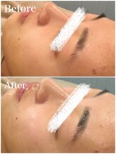 ビビィ(Bibiy)/毛穴洗浄