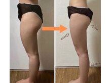 ヨサパーク リアン(YOSA PARK Lien)/before（左）→after（右）