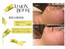 アンジュの雰囲気(【脂肪分解剤】レモンボトルでお顔・ボディの脂肪にさよなら!)