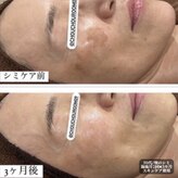 ミニョン(Mignon)