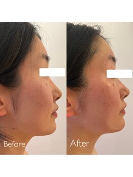 フセヤ &nbsp;エステティックアロマヨガスクール(FUSEYA)/WINBACK フェイシャル 一宮/癒し