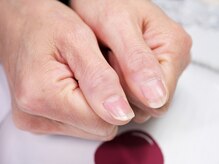 B.base atelier/◆ハンドケア（Before）