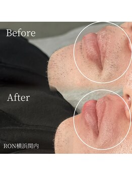 サロンロン 横浜関内(SALON RON)/