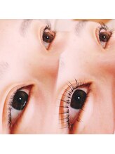 コア(Koa)/before　after