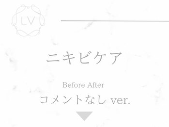 ラヴィオーラ 栄(LV)/ダイヤモンドハーブピーリング