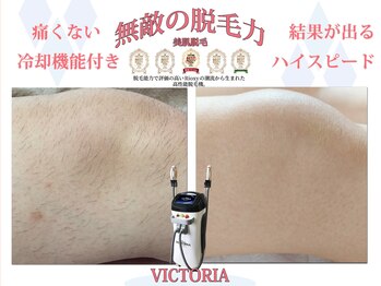 ディアメ(Diame)/無敵の美肌脱毛!!