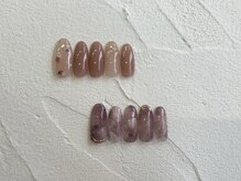 プラルーチェ(Platluce)/【定額】Lコース