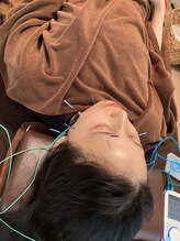 ハリファ鍼灸院 横浜関内院(HariFa鍼灸院)/美容施術