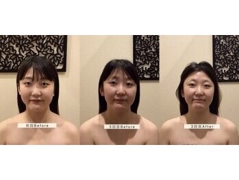 アジール 長岡リバーサイド千秋店(agir)/before/after画像