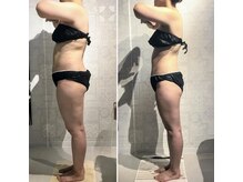 サンテボーテ(Sante Beaute)の雰囲気（3ヶ月で-8キロダウン！ウエスト-10ｃｍ太もも-6cmのサイズダウン）