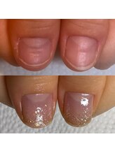 ウェルズユキ(well's yuki)/爪をいじってしまう/凸凹爪