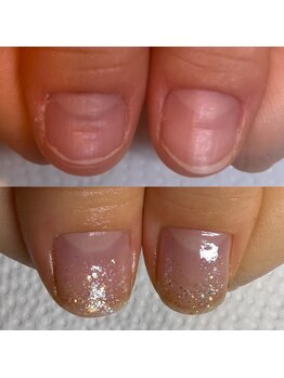 ウェルズユキ(well's yuki)/爪をいじってしまう/凸凹爪