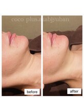 ココプラス(COCO plus.)/小顔効果抜群レモンボトルで小顔