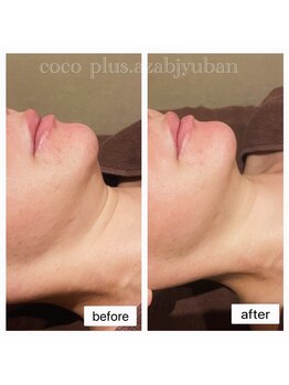 ココプラス(COCO plus.)/小顔効果抜群レモンボトルで小顔