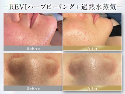 レイビューティサロン(Lei beauty salon)の写真