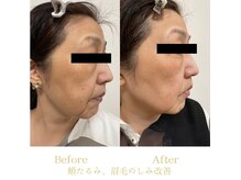 アスポーテ(ASBEAUTE)