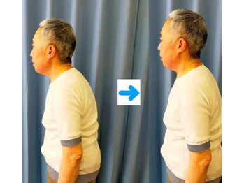 いのくち接骨院/姿勢改善の症例