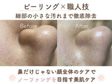ミサズ スキンケア(misa's skin care)