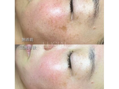 ルシアル 代々木店(LUCIAL)の写真