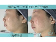 リメイクビューティークリニック(REMAKE BEAUTY CLINIC)/小顔、リフトアップ、たるみケア