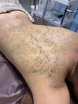 グロッシー(GLOSSY)/【陶肌】背中ハーブピーリング