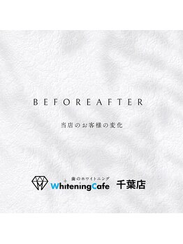 ホワイトニングカフェ 千葉店/ホワイトニングビフォーアフター