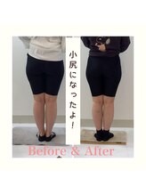 スタイルラボ高松/産後の骨盤矯正の効果♪