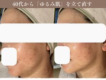 ポレ サロ(pore salo)