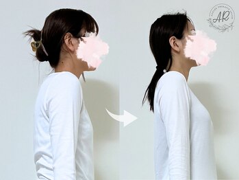 エーアール(AR)/【Before/After】3回目