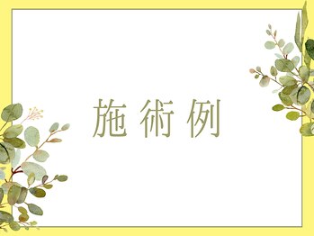 ブルースター 上小田井店(Blue Star)/【施術例】