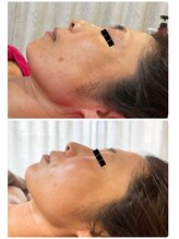 ロッシュ フェイス(Roche Face)/40代女性