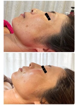 ロッシュ フェイス(Roche Face)/40代女性