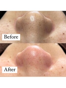 キキ(kiki)/長年のお悩みが１回で解決