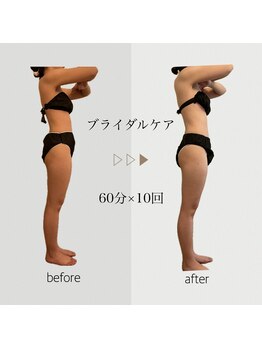 ファミーユ 名古屋店/【ブライダルケア】ドレス映え