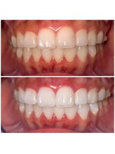 ライトビューティー 池袋店(LightBeauty)/症例写真