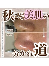 ミュウ(miuex)/秋こそ毛穴ケア