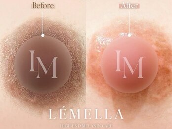 ジジベレッザ 大阪中崎町店(jiji belleza)