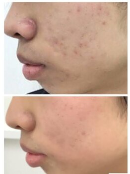 スリリアン 銀座/★お客さまビフォーアフター★